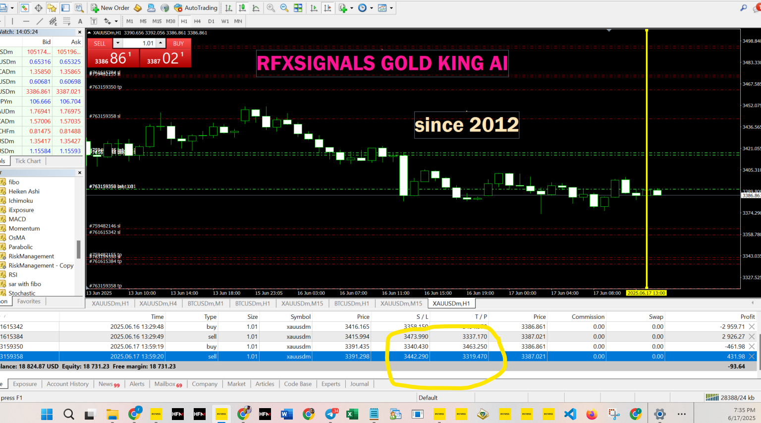 Tired of Guessing the Market? This AI Uses One Number to Revolutionize Gold Trading Trade 14
