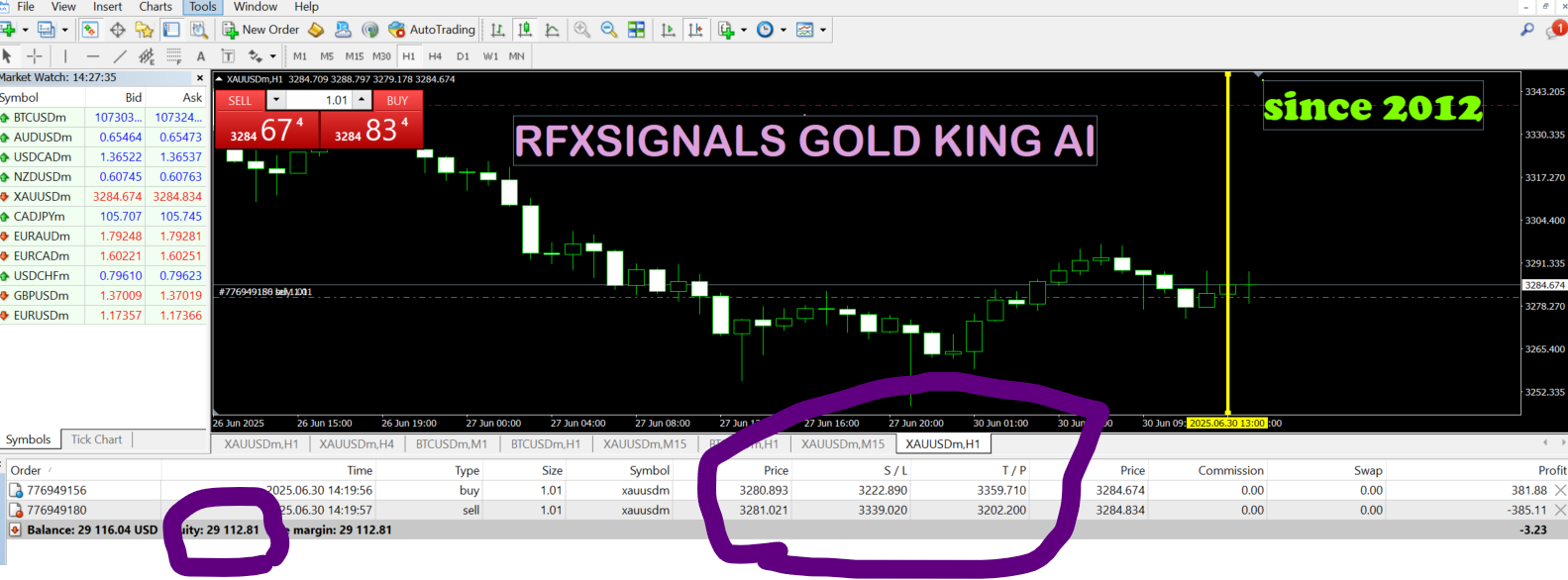 Start Your Forex Journey Today—No Experience Required!